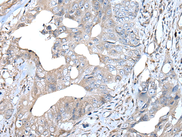Rabbit Polyclonal Antibody to IL2
