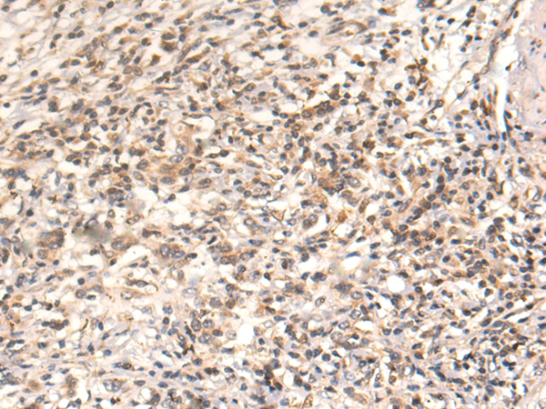 Rabbit Polyclonal Antibody to IL15