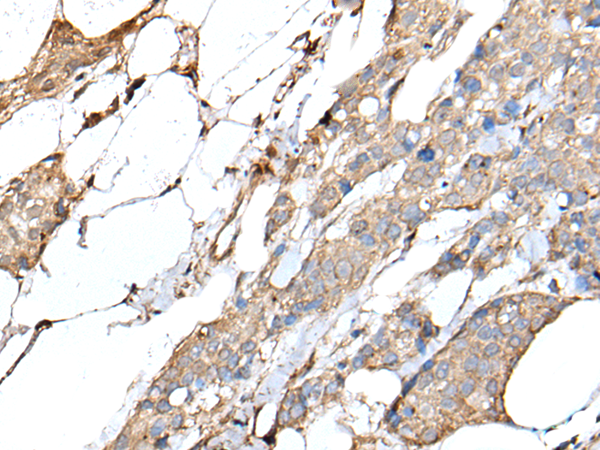 Rabbit Polyclonal Antibody to IL20