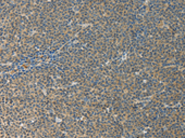 Rabbit Polyclonal Antibody to IL27