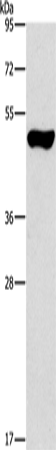 Rabbit Polyclonal Antibody to ILK