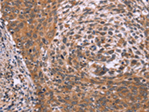 Rabbit Polyclonal Antibody to ING2