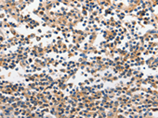 Rabbit Polyclonal Antibody to INHA
