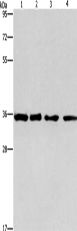 Rabbit Polyclonal Antibody to INHBC