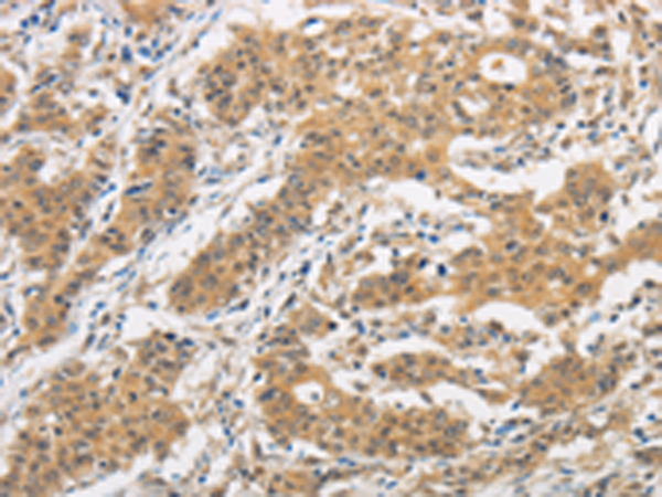 Rabbit Polyclonal Antibody to ITGB3BP