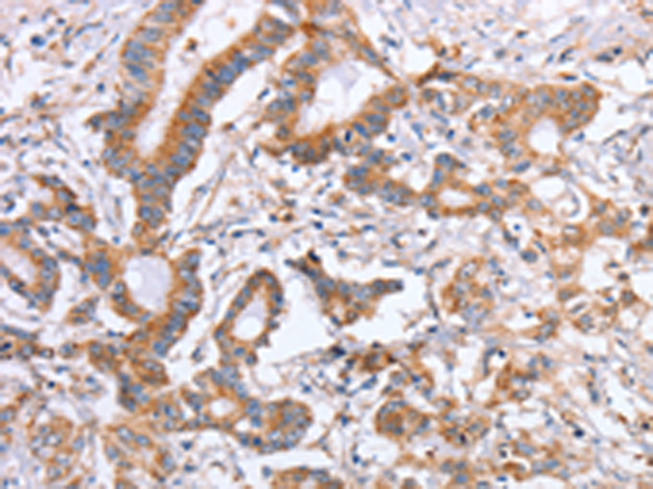 Rabbit Polyclonal Antibody to ITGB5