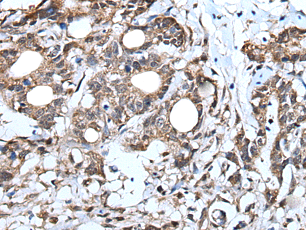 Rabbit Polyclonal Antibody to IRF4
