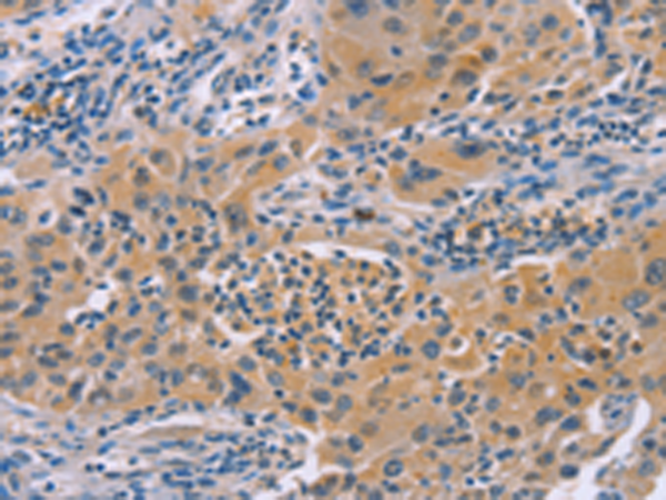 Rabbit Polyclonal Antibody to IRF3
