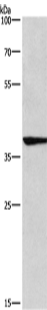 Rabbit Polyclonal Antibody to IRF9