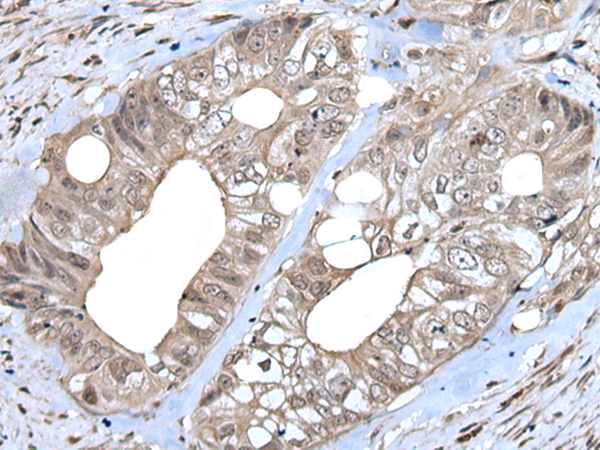 Rabbit Polyclonal Antibody to IRF8