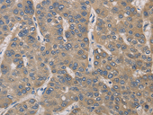 Rabbit Polyclonal Antibody to IRAK4