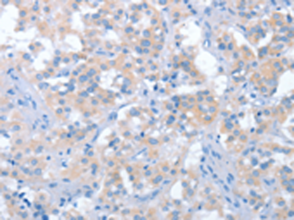 Rabbit Polyclonal Antibody to IRAK3