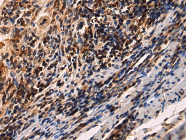 Rabbit Polyclonal Antibody to IRAK2