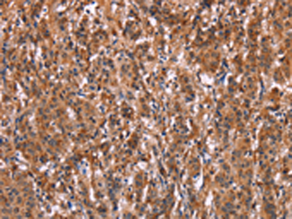 Rabbit Polyclonal Antibody to LILRB1