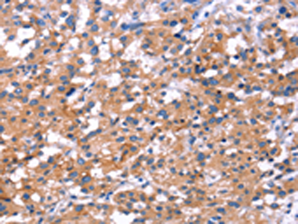 Rabbit Polyclonal Antibody to IRS1