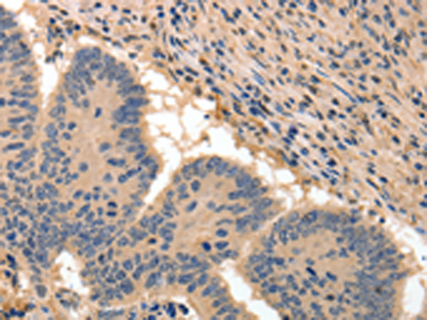 Rabbit Polyclonal Antibody to BAIAP2