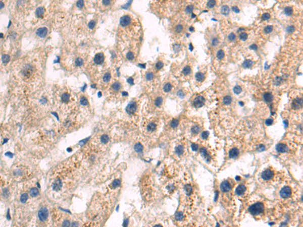 Rabbit Polyclonal Antibody to ITGA4
