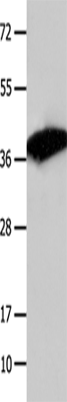Rabbit Polyclonal Antibody to COPS5