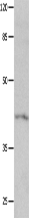 Rabbit Polyclonal Antibody to KCNA5