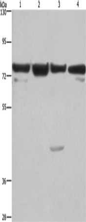 Rabbit Polyclonal Antibody to KLF11