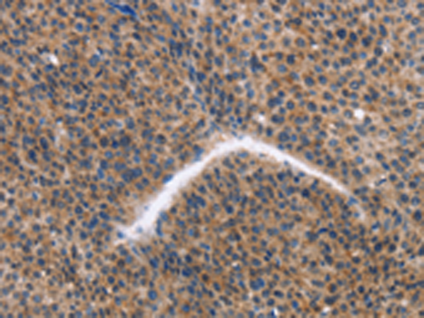 Rabbit Polyclonal Antibody to KLF15