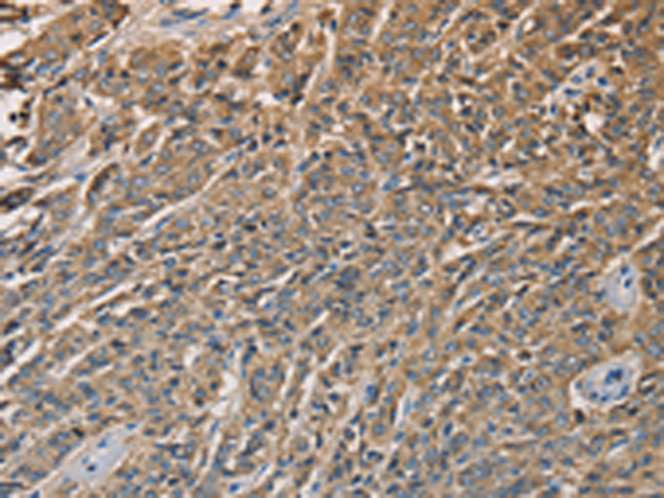 Rabbit Polyclonal Antibody to KLK1