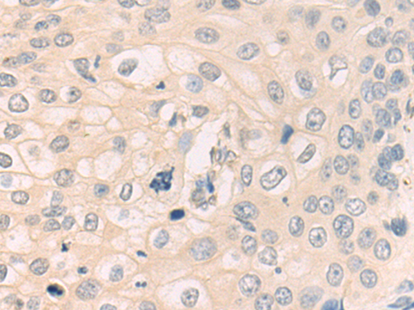 Rabbit Polyclonal Antibody to KLK4
