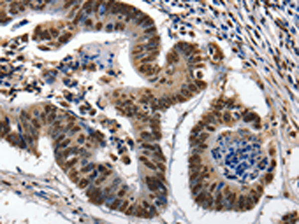 Rabbit Polyclonal Antibody to KLK7