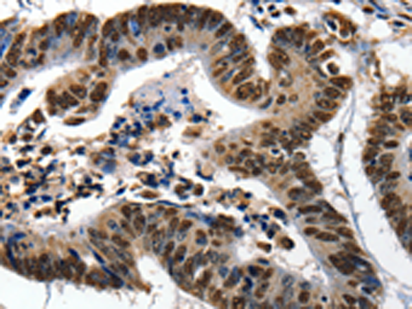 Rabbit Polyclonal Antibody to XRCC6