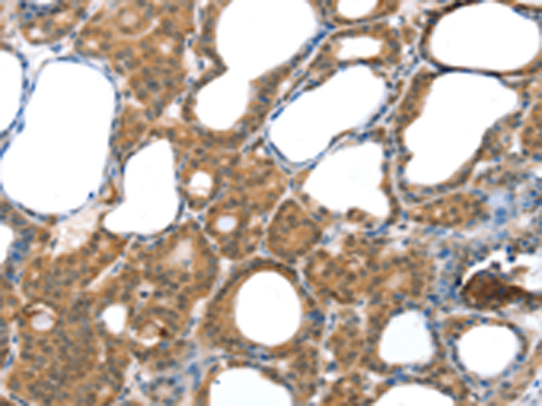 Rabbit Polyclonal Antibody to LAMA4