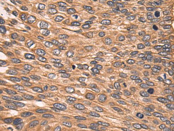 Rabbit Polyclonal Antibody to LAIR1