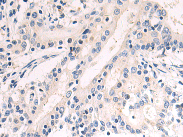 Rabbit Polyclonal Antibody to LCAT