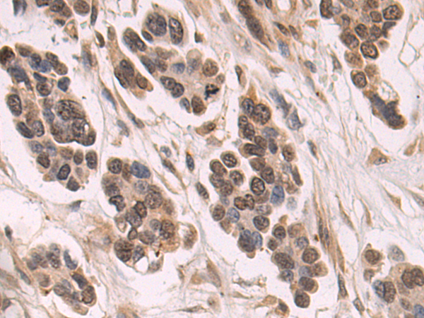 Rabbit Polyclonal Antibody to LEF1