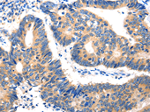 Rabbit Polyclonal Antibody to HDC