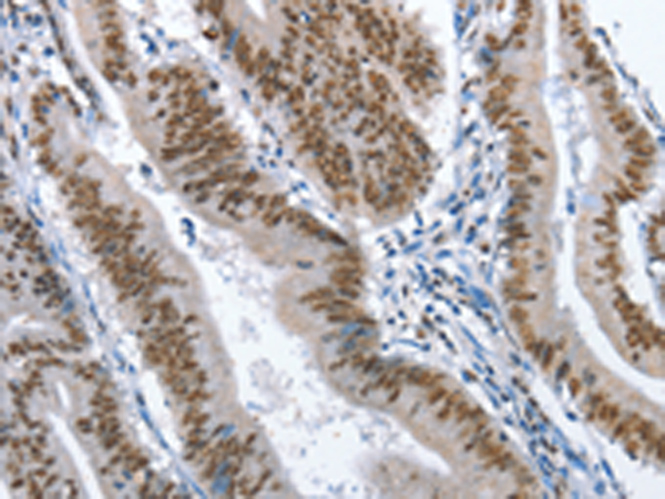 Rabbit Polyclonal Antibody to GNRH1