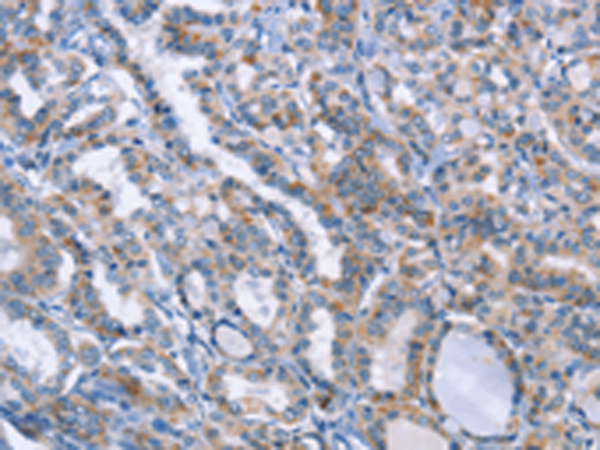 Rabbit Polyclonal Antibody to LRRK2