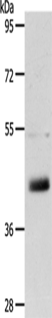 Rabbit Polyclonal Antibody to LYVE1