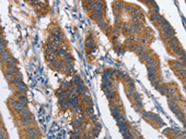 Rabbit Polyclonal Antibody to MAD2L1BP