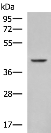 Rabbit Polyclonal Antibody to FBXO32