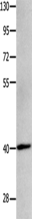 Rabbit Polyclonal Antibody to MAGEB4