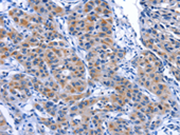 Rabbit Polyclonal Antibody to MYH1