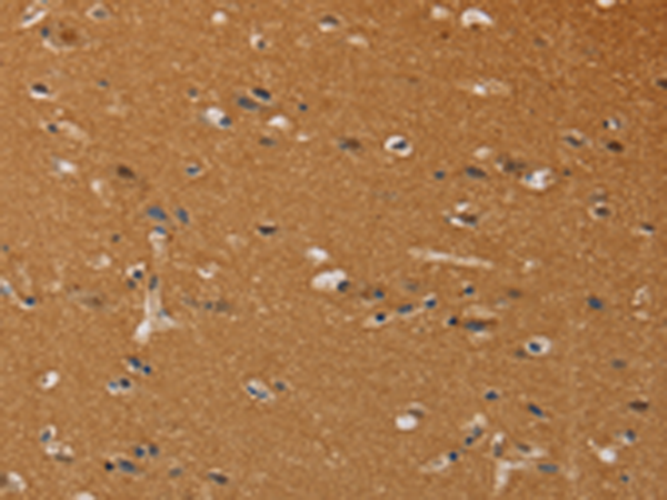 Rabbit Polyclonal Antibody to CHRNA4
