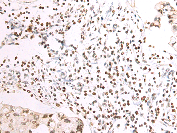 Rabbit Polyclonal Antibody to NAIF1
