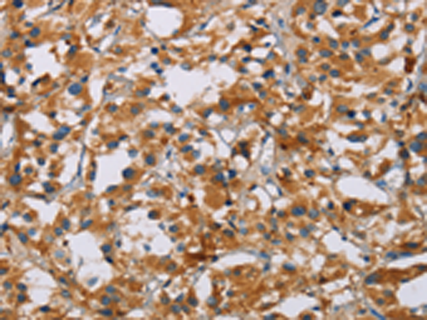 Rabbit Polyclonal Antibody to NRN1