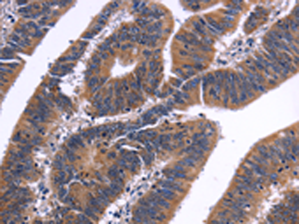 Rabbit Polyclonal Antibody to NFATC3