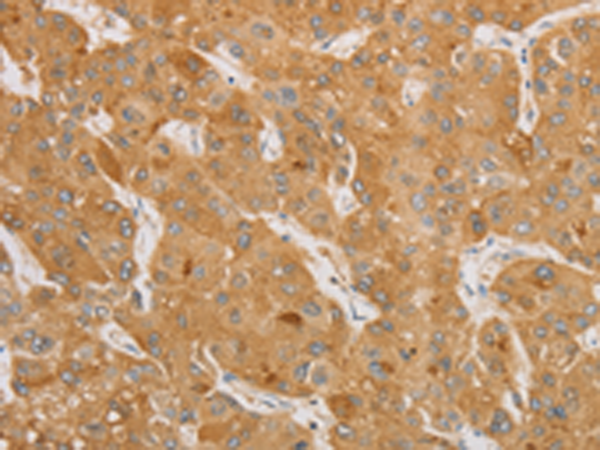Rabbit Polyclonal Antibody to NGF