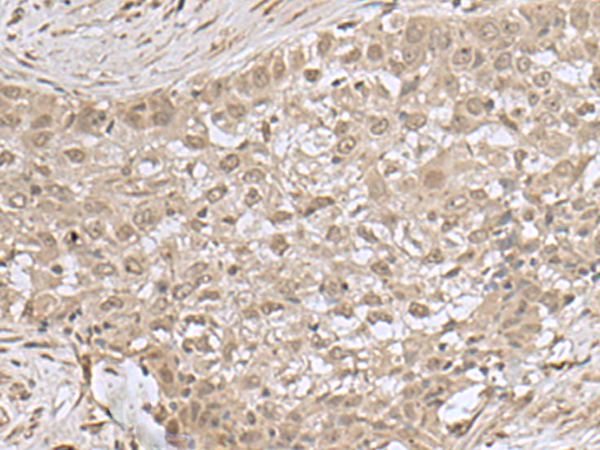 Rabbit Polyclonal Antibody to NEUROG3