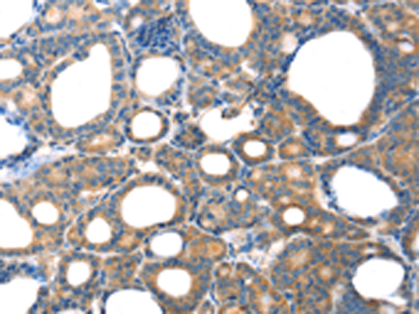 Rabbit Polyclonal Antibody to TAC1
