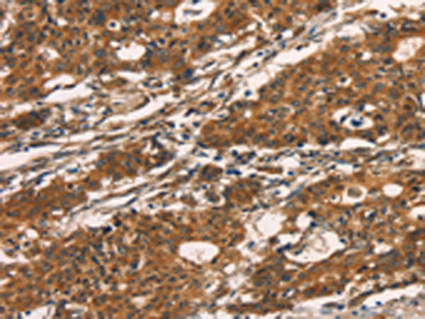 Rabbit Polyclonal Antibody to KLRC1