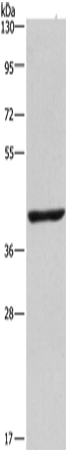 Rabbit Polyclonal Antibody to NME7